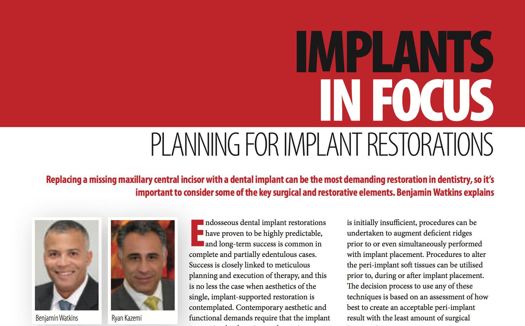 The DualZone Therapeutic Concept of Managing Immediate Implant